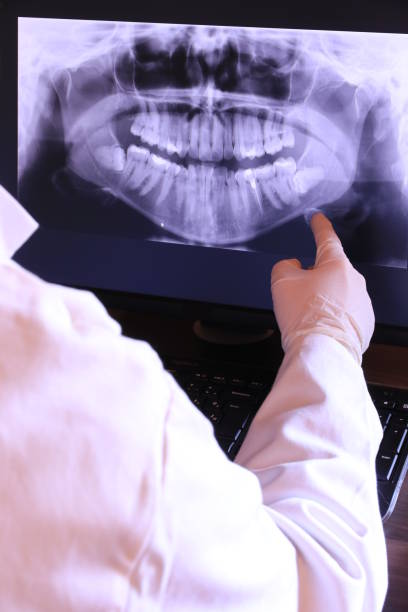 Best Emergency Wisdom Tooth Extraction in Seven Fields, PA